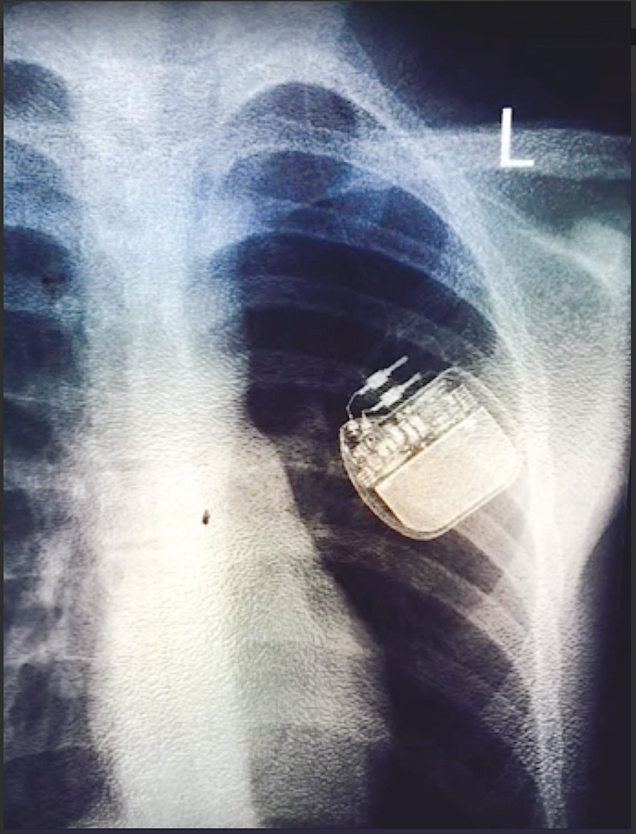 Screen Shot 2019-07-17 at 5.10.29 pm